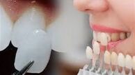 مناسب‌ترین شیوه تغییر فرم دندان‌ها به جای ارتودنسی